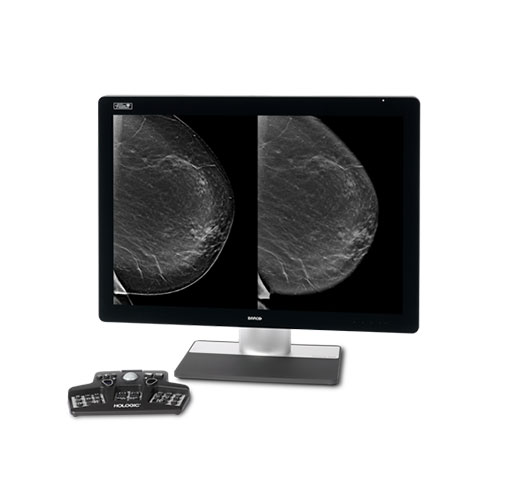 Sistema de imagem sintetizada Intelligent 2D™ da Hologic em fundo branco