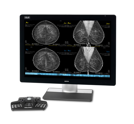 Estação de trabalho para mamografia SecurView® da Hologic em fundo branco