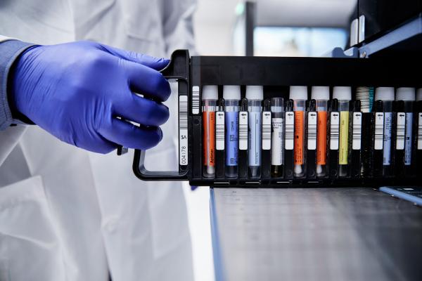 Técnico a usar luvas a tocar num suporte de testes PCR