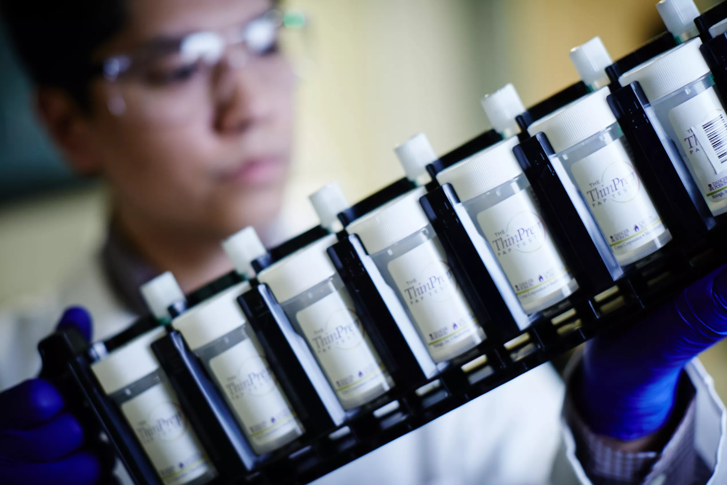 Técnica de laboratório com óculos de proteção a segurar um tabuleiro de frascos