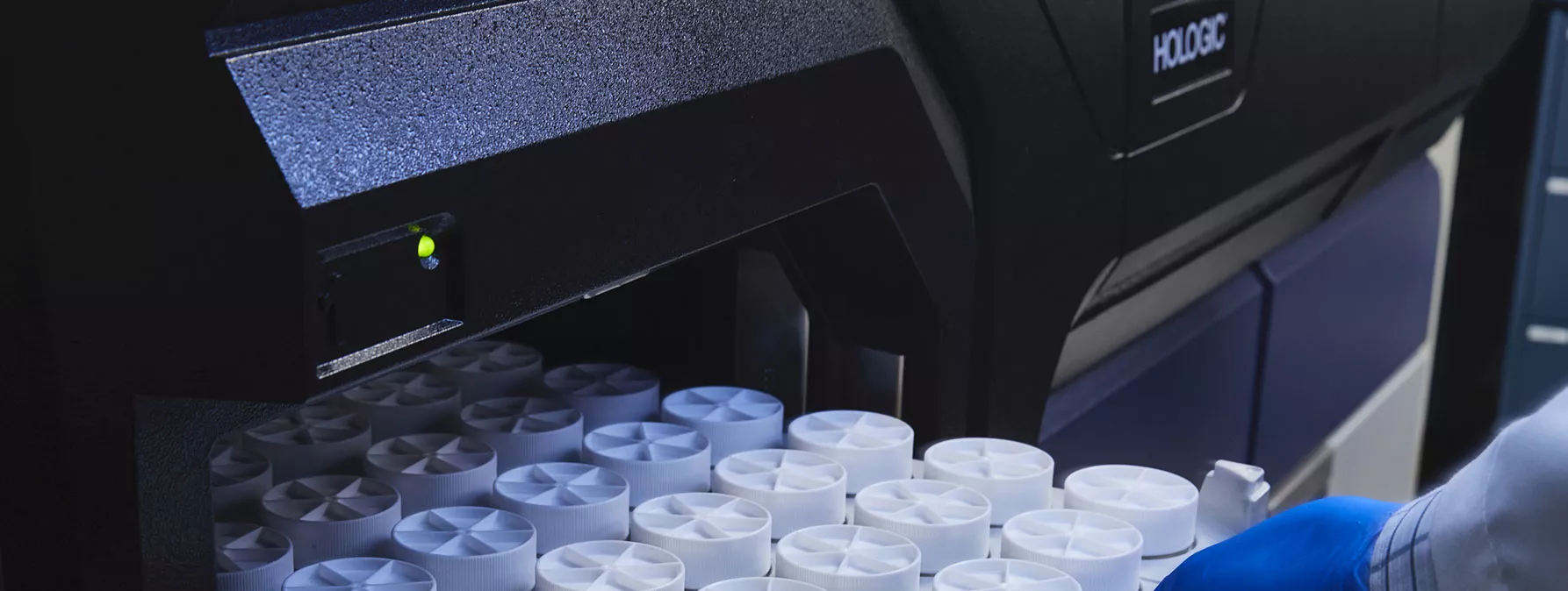 Mão enluvada retirando bandeja de espécimes