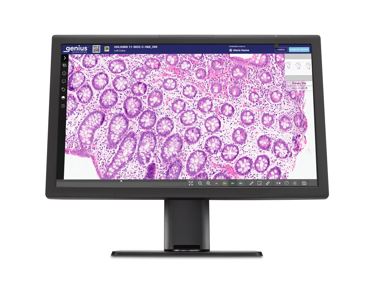 O monitor Genius a apresentar células de histologia prontas para análise