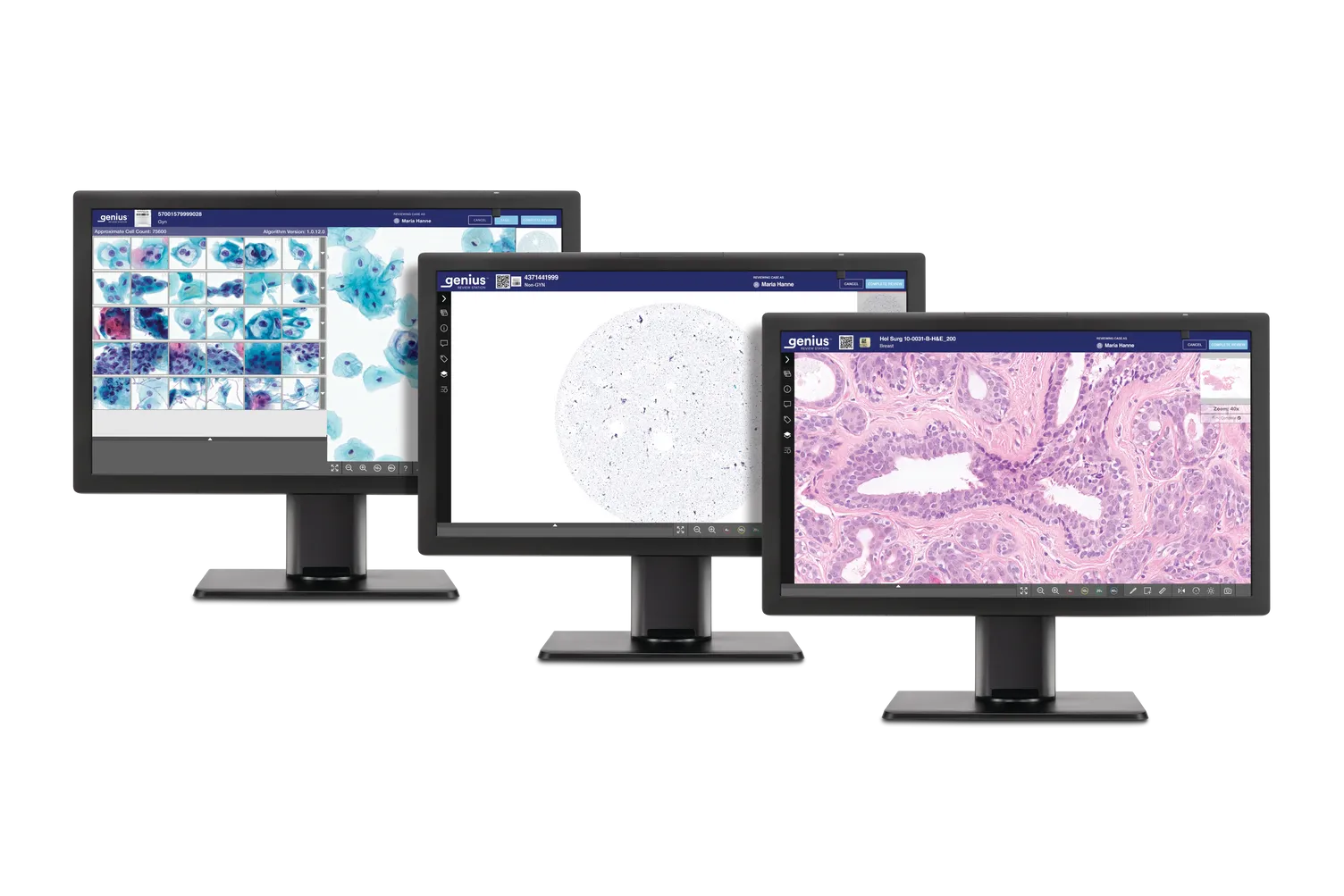 3 monitores Genius a apresentar imagens de histologia e citologia prontas para análise.