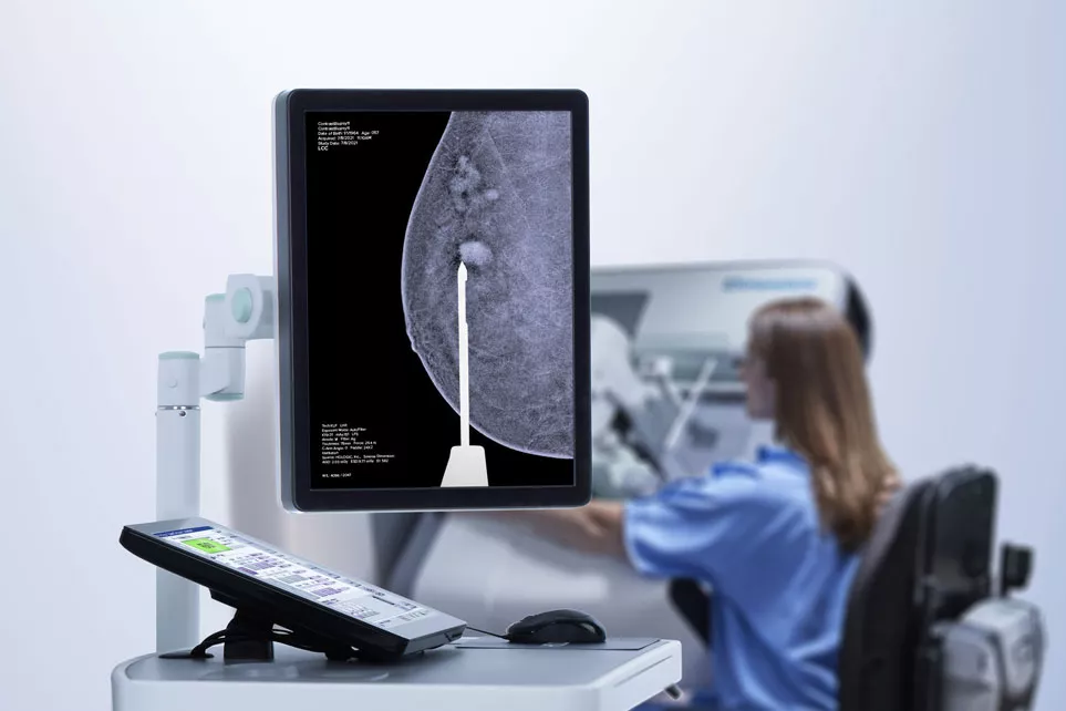Mamografia com contraste 3D num monitor
