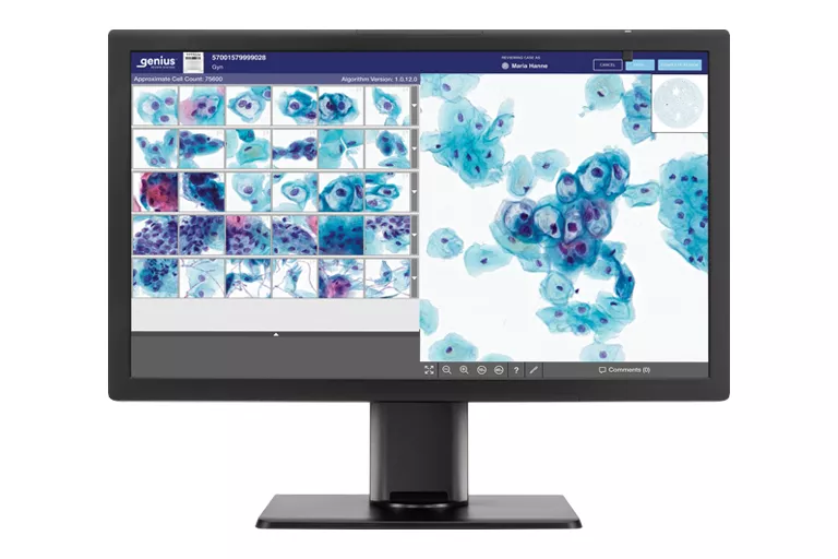 Imagem do monitor Genius