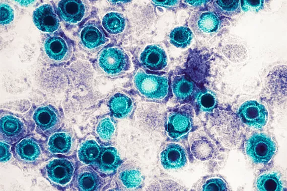 Imagem de microscópio do vírus