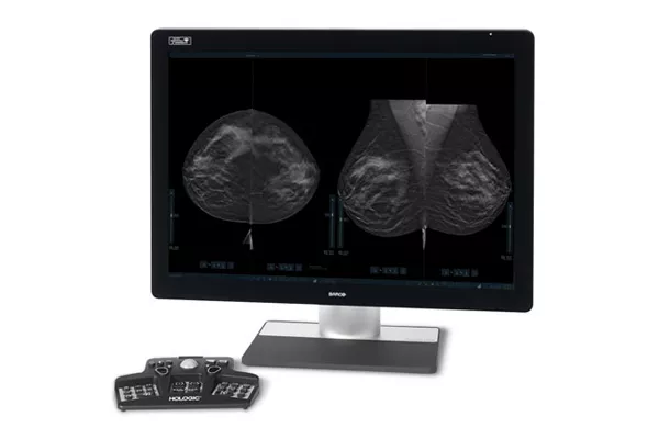 Monitor que exibe mamografias com keypad
