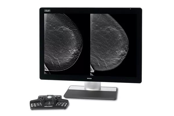 Monitor que exibe mamografias com keypad