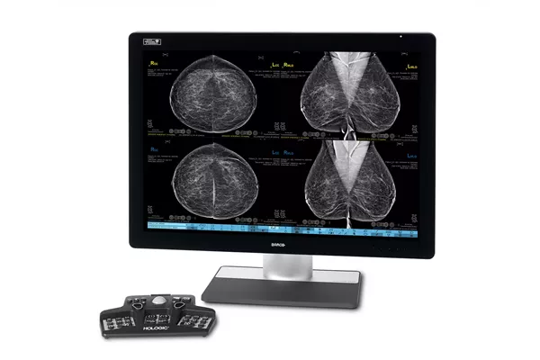 Monitor que exibe mamografias com keypad