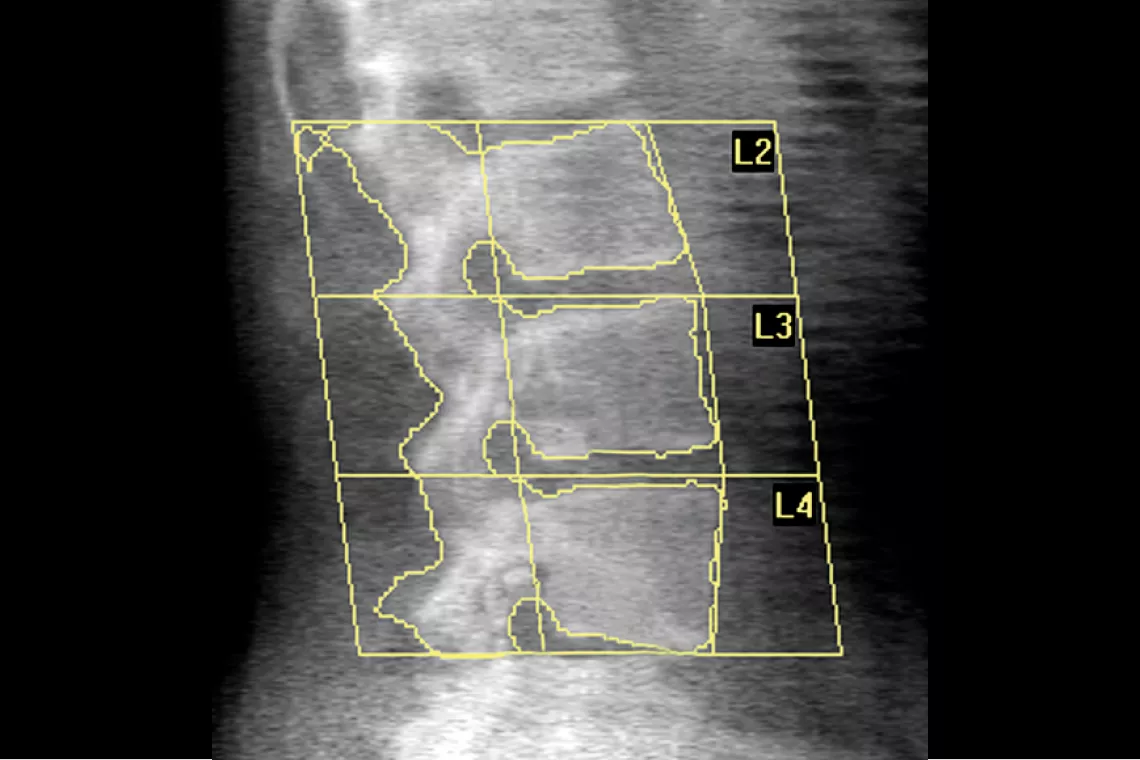 radiografia da coluna