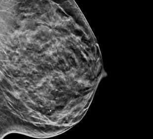 Sistema de imagem 2D sintetizada C-View™ da Hologic em fundo branco